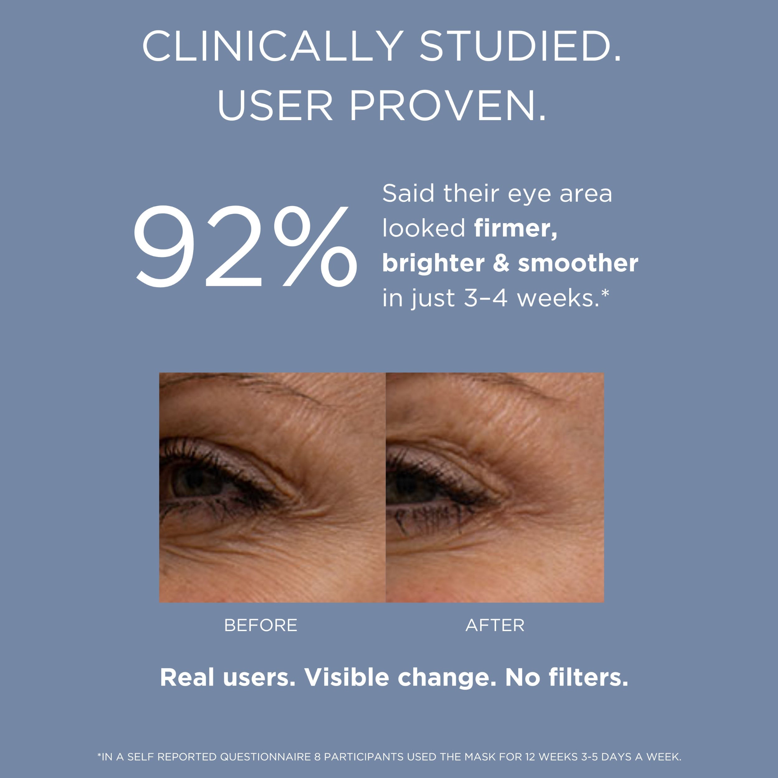 Avant/aprés du LED Eye Refresh Pro Solaris Lab NY. 92% rapportent une contour de l'oeil plus clair, plus ferme et plus lisse 