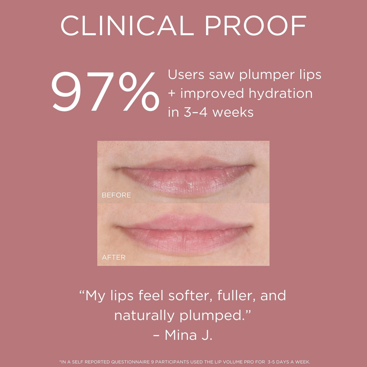 IR+LED Lip Volume Pro - Solaris Lab NY – Superskin
