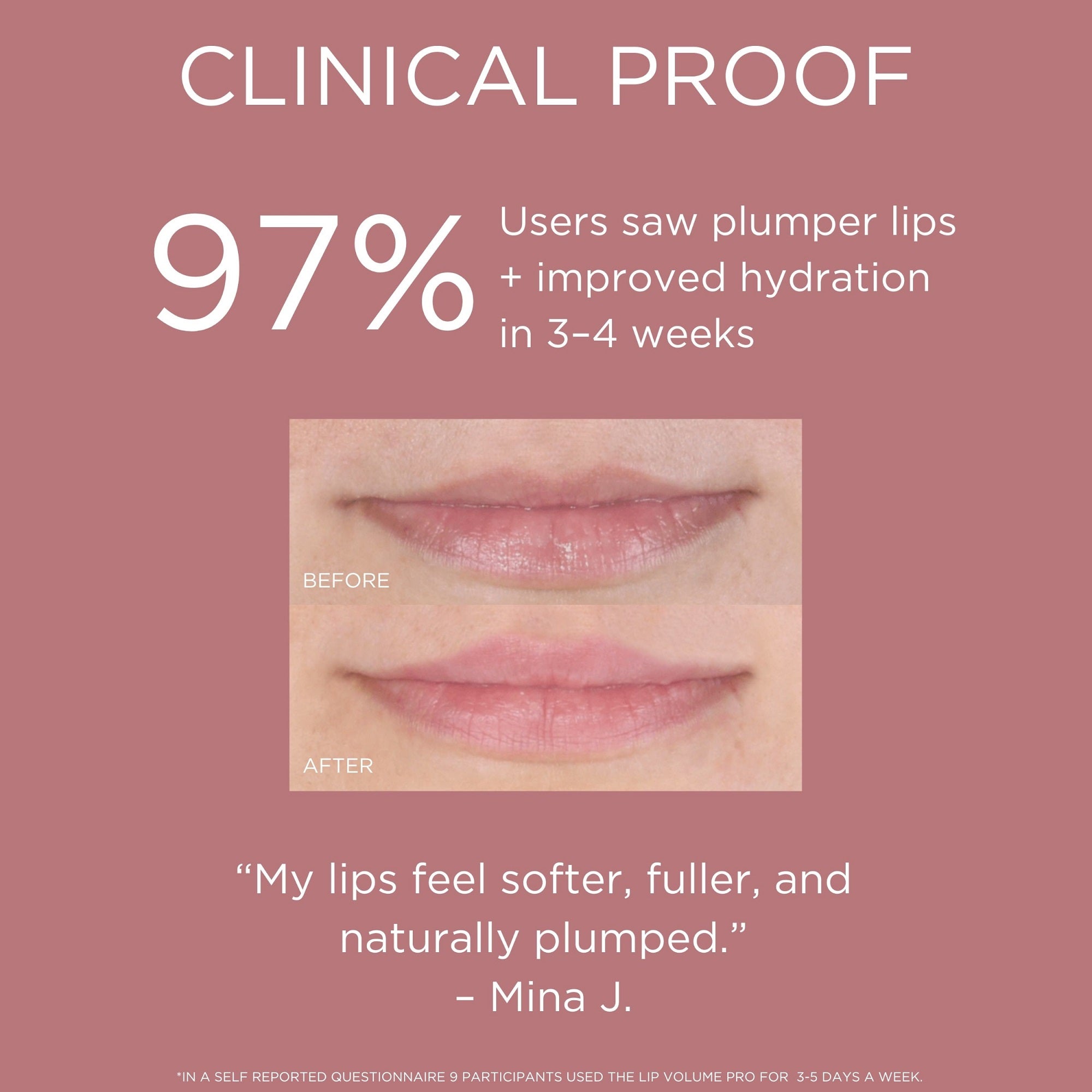 97% des utilisateurs ont remarqué plus de volume et plus d'hydratation après 3-4 semaines d'utilisation du LED lip volume pro solaris lab NY. 