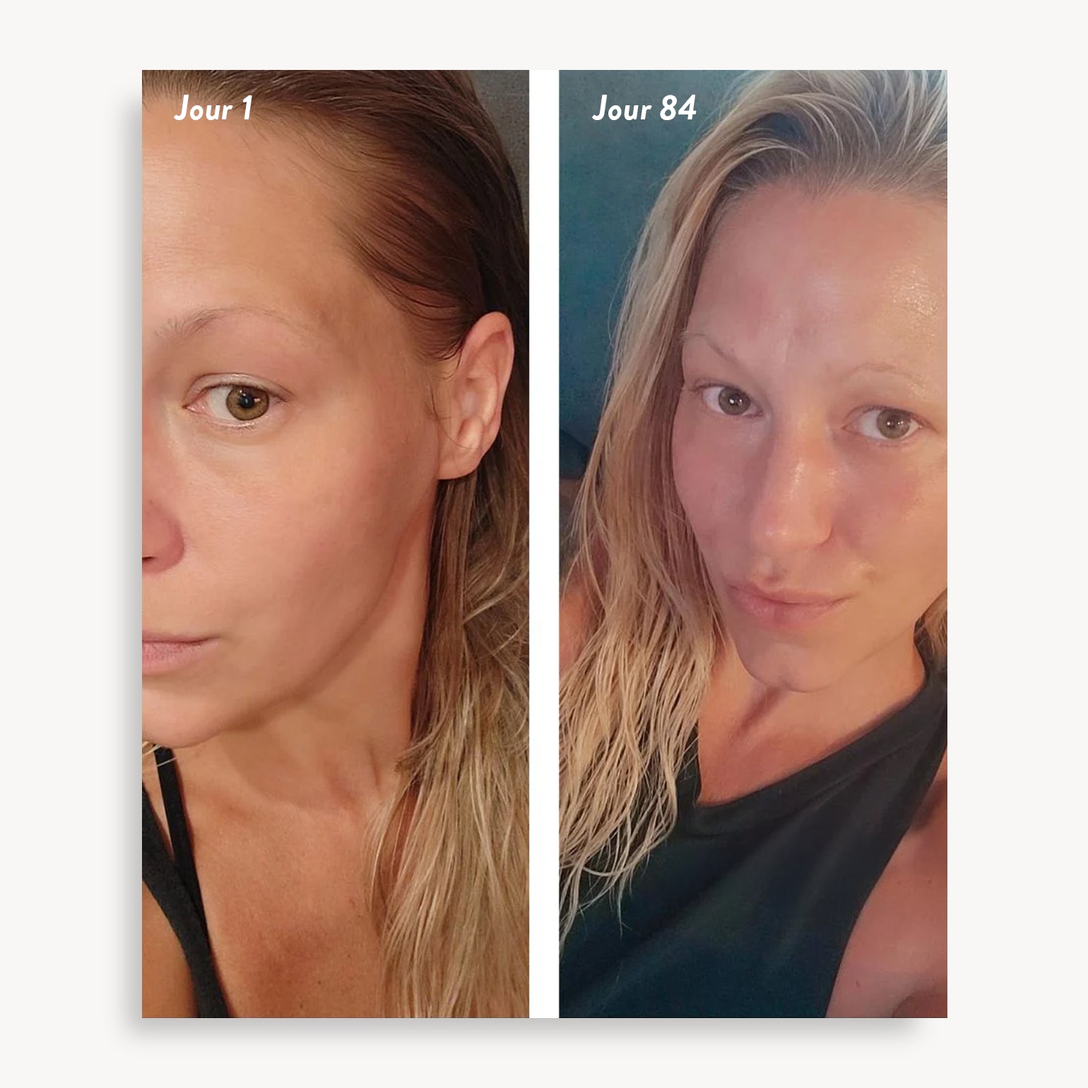 holi (growth) 84 leave-in hair growth scalp spray - Agent Nateur