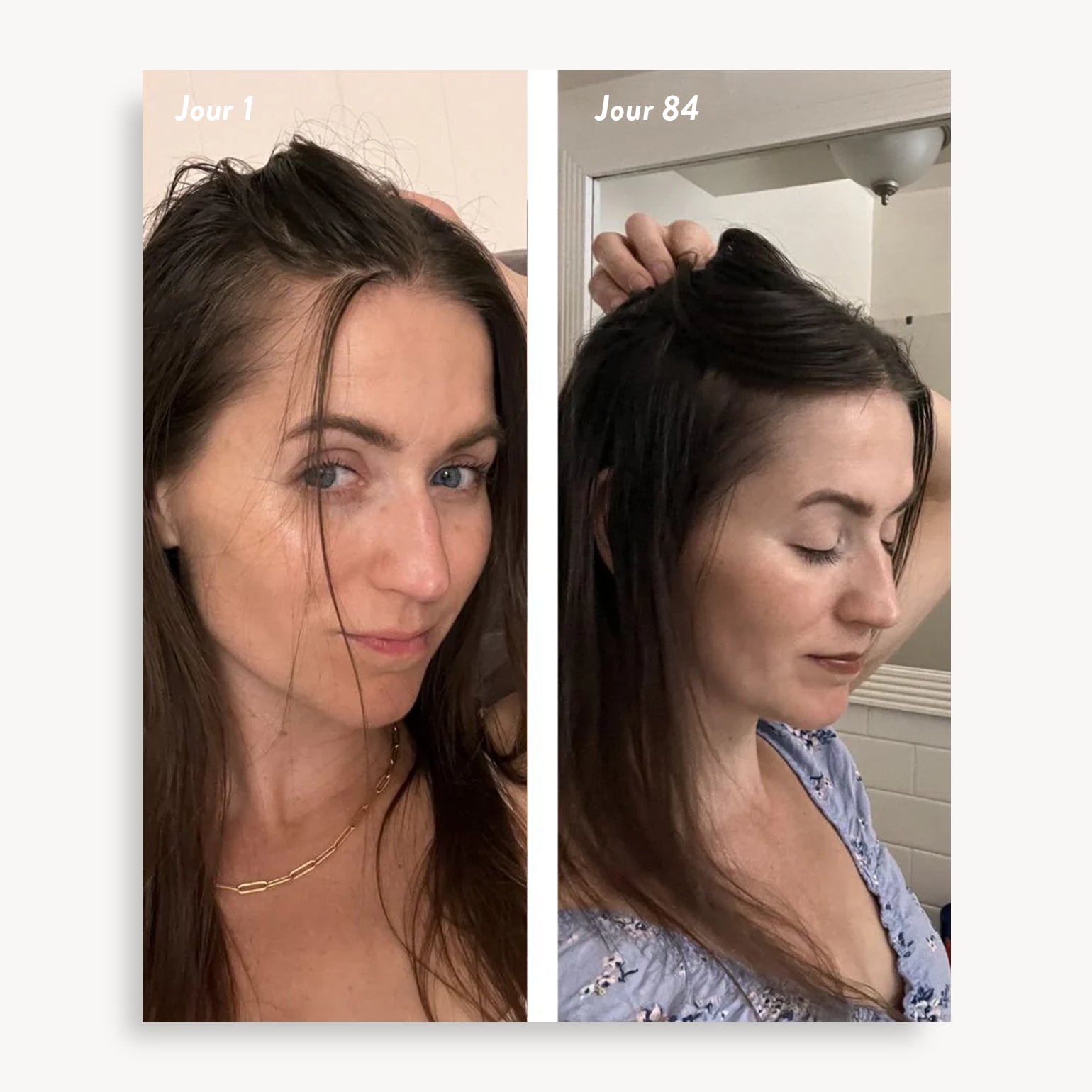 holi (growth) 84 leave-in hair growth scalp spray - Agent Nateur