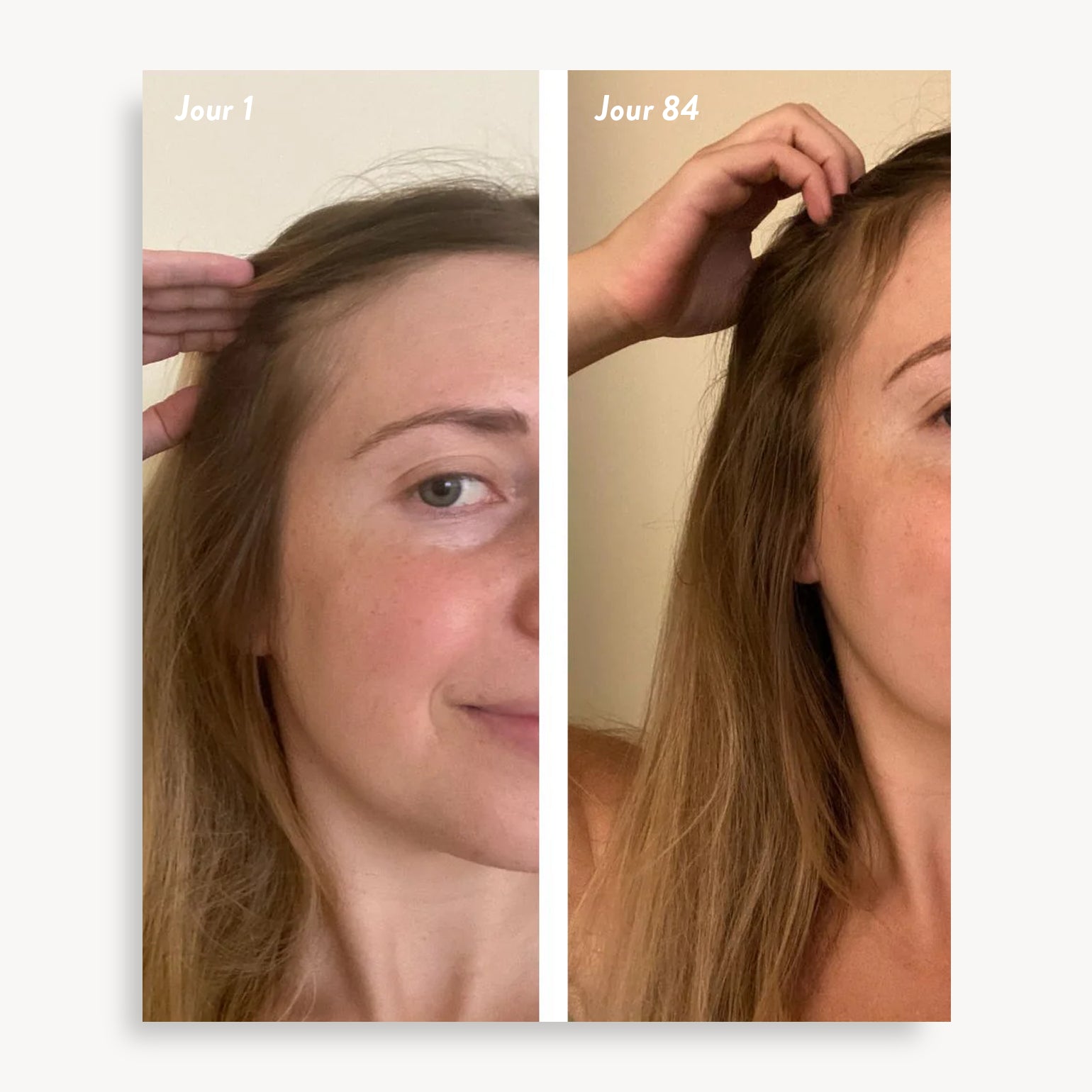 holi (growth) 84 leave-in hair growth scalp spray - Agent Nateur