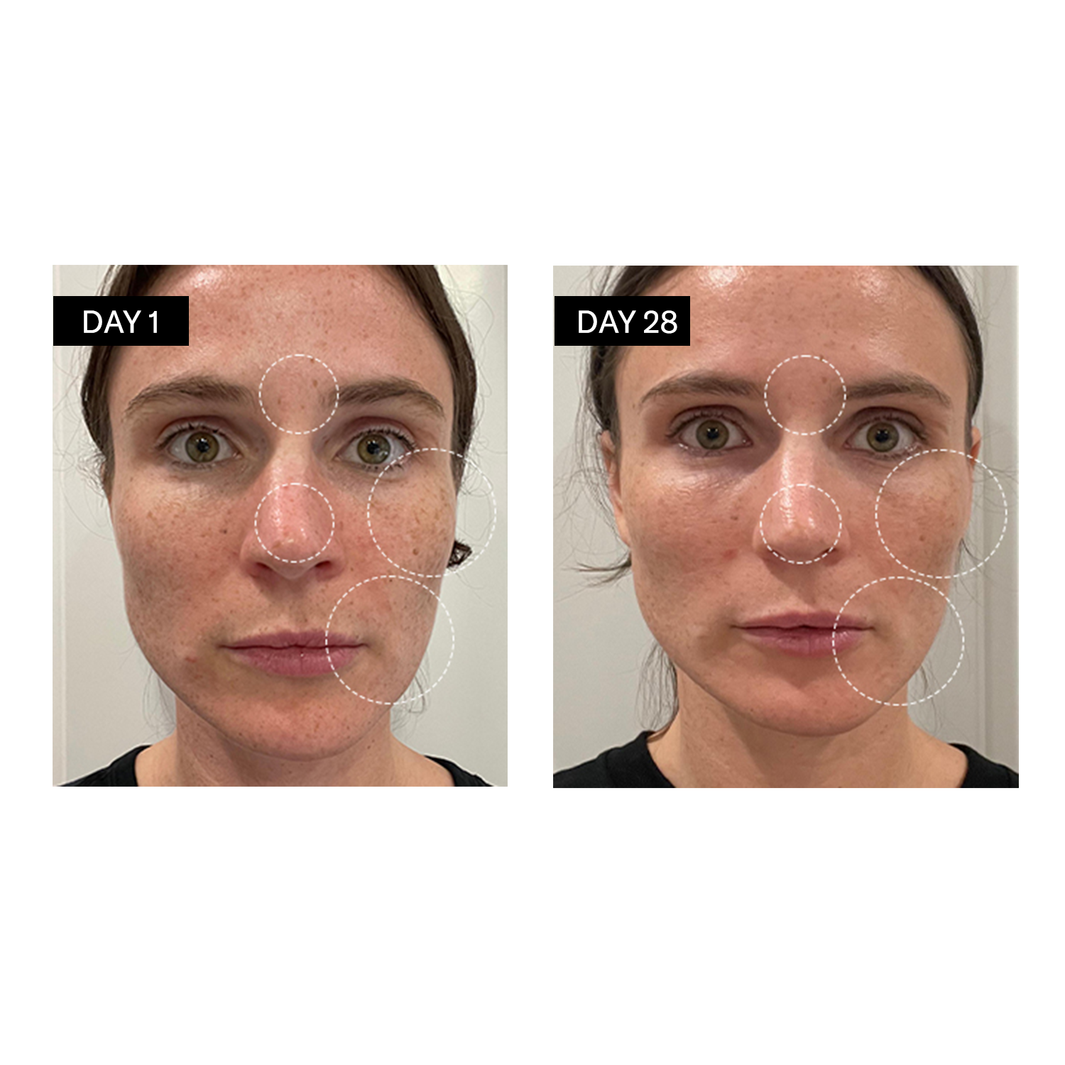 Avant / après : Sérum Eclaircissant - Vitamine C & E + Acide Hyaluronique - Odacité