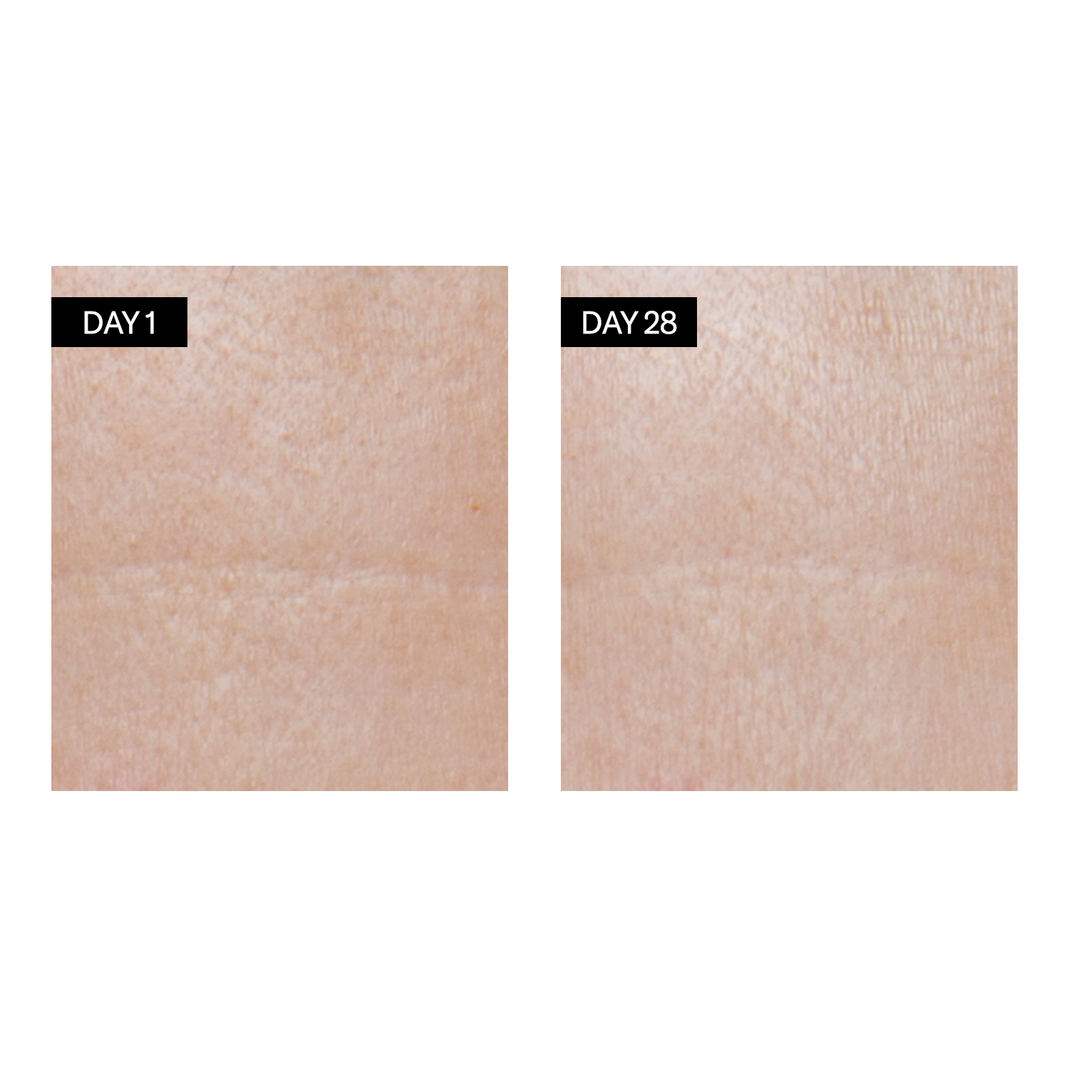 Avant /après : Sérum Rénovant - Rétinol + Acide Hyaluronique - Odacité