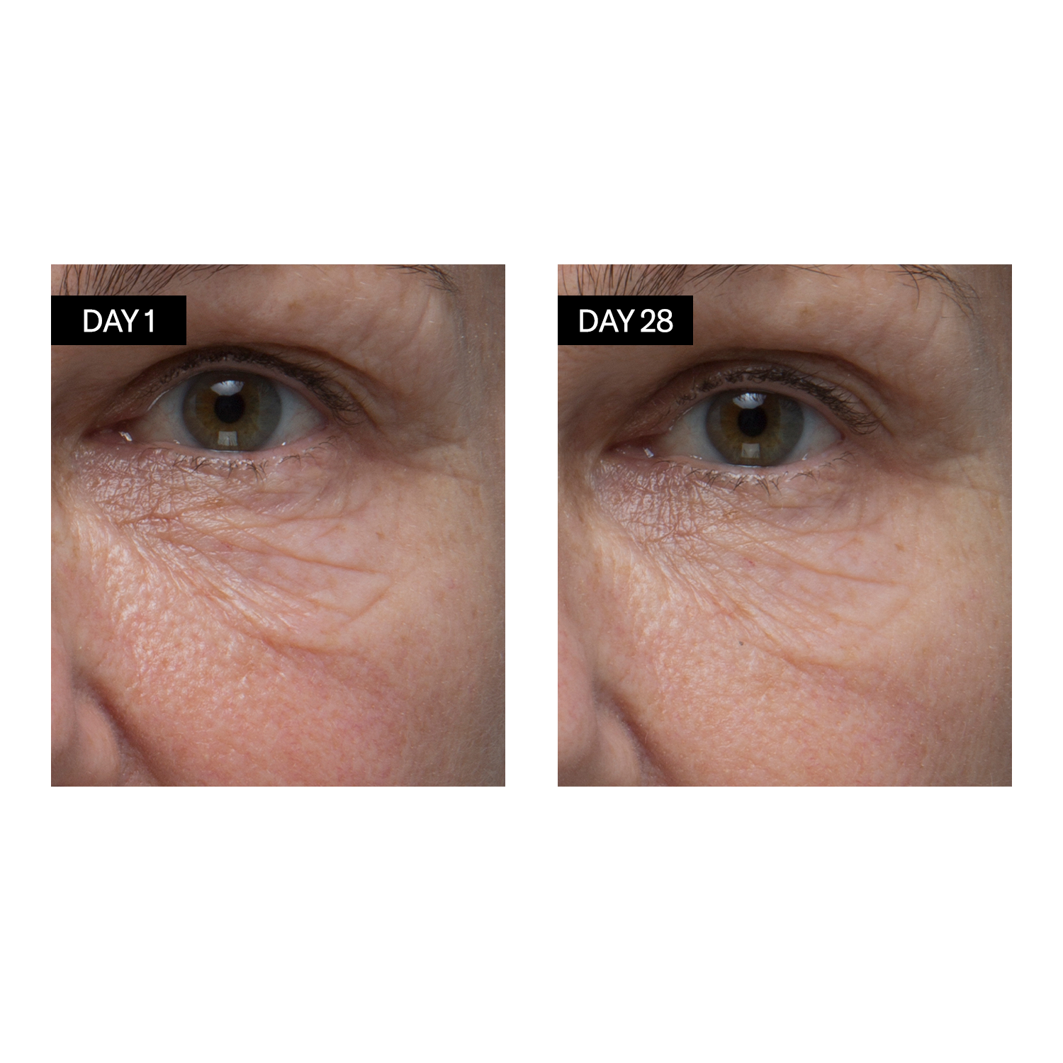 Avant /après : Sérum Rénovant - Rétinol + Acide Hyaluronique - Odacité